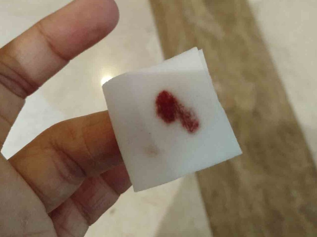 hasil rapid test